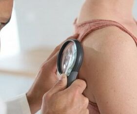 How to determine the human papillomavirus