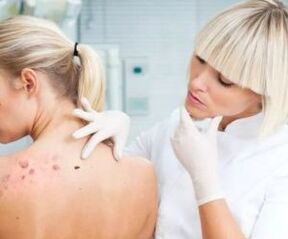 Symptoms of human papillomavirus