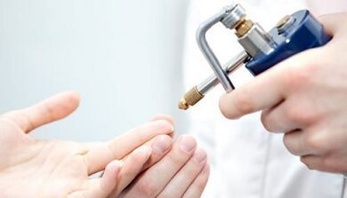 Crossing as a method of treating warts
